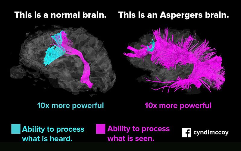 Asperger_vs_normal_brain.jpg